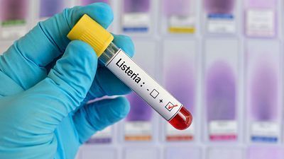 Sanidad sigue de cerca la evolución del brote de listeriosis 